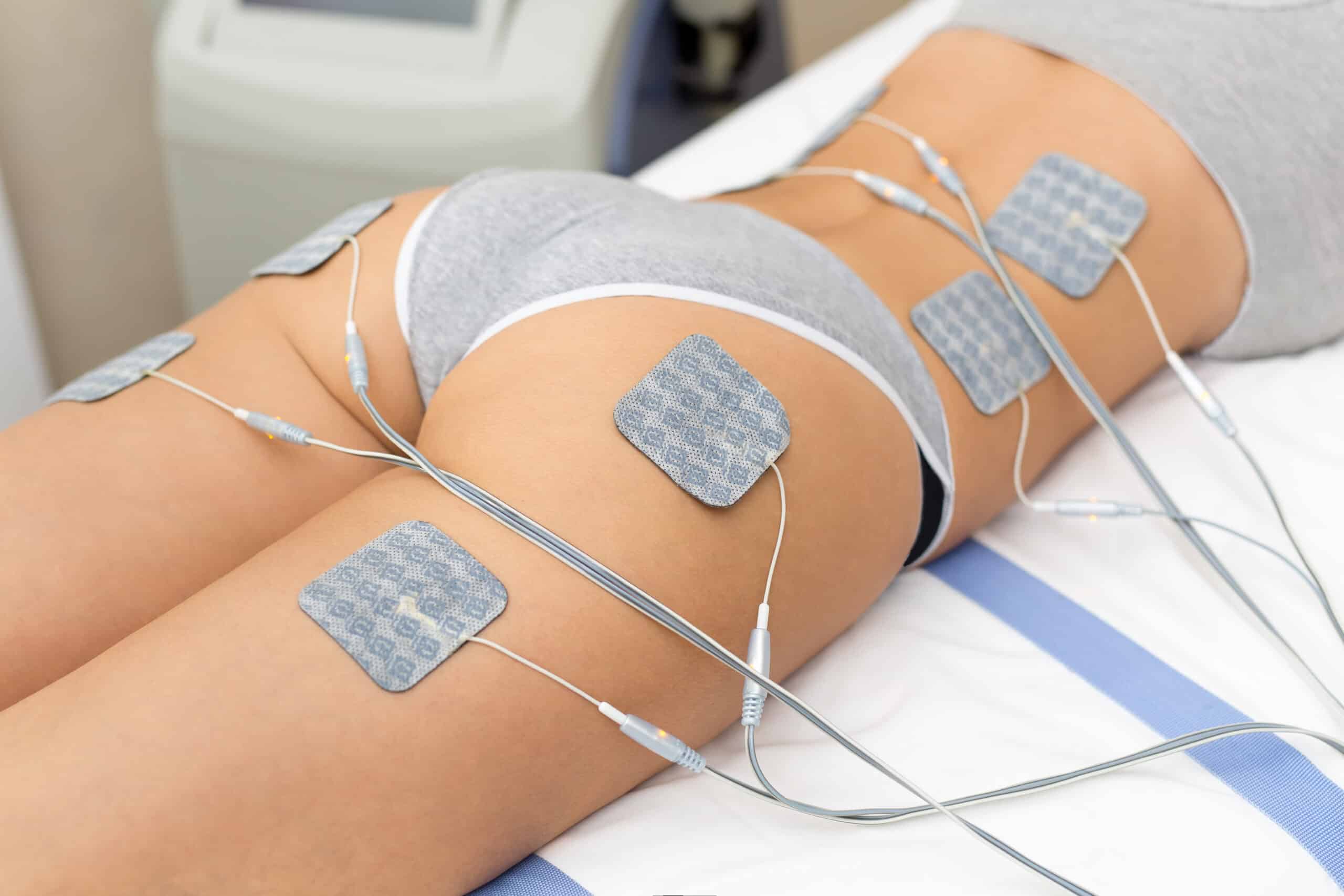 Corps d'une femme allongée traitée par électrostimulation musculaire (EMS) avec des électrodes posées sur les fessiers et les cuisses.